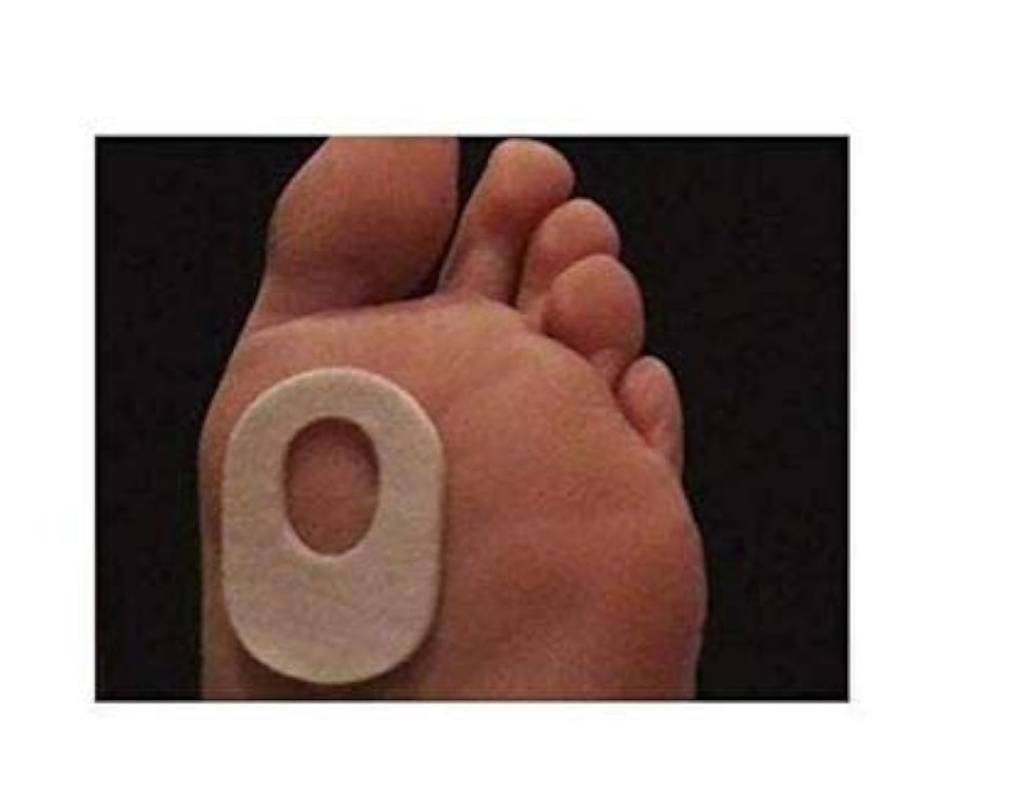 Atlas Biomechanics Callus Pads, 40/ Pack, 1/8" Adhesive Felt Oval Foot Cushions