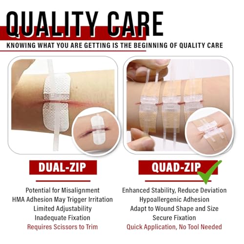 EVERLIT Wound Closure Kit | Surgical Zip-Stitch Devices for Cut & Laceration | Sterile, Suture-Free, Stitch-Less Adhesive ...