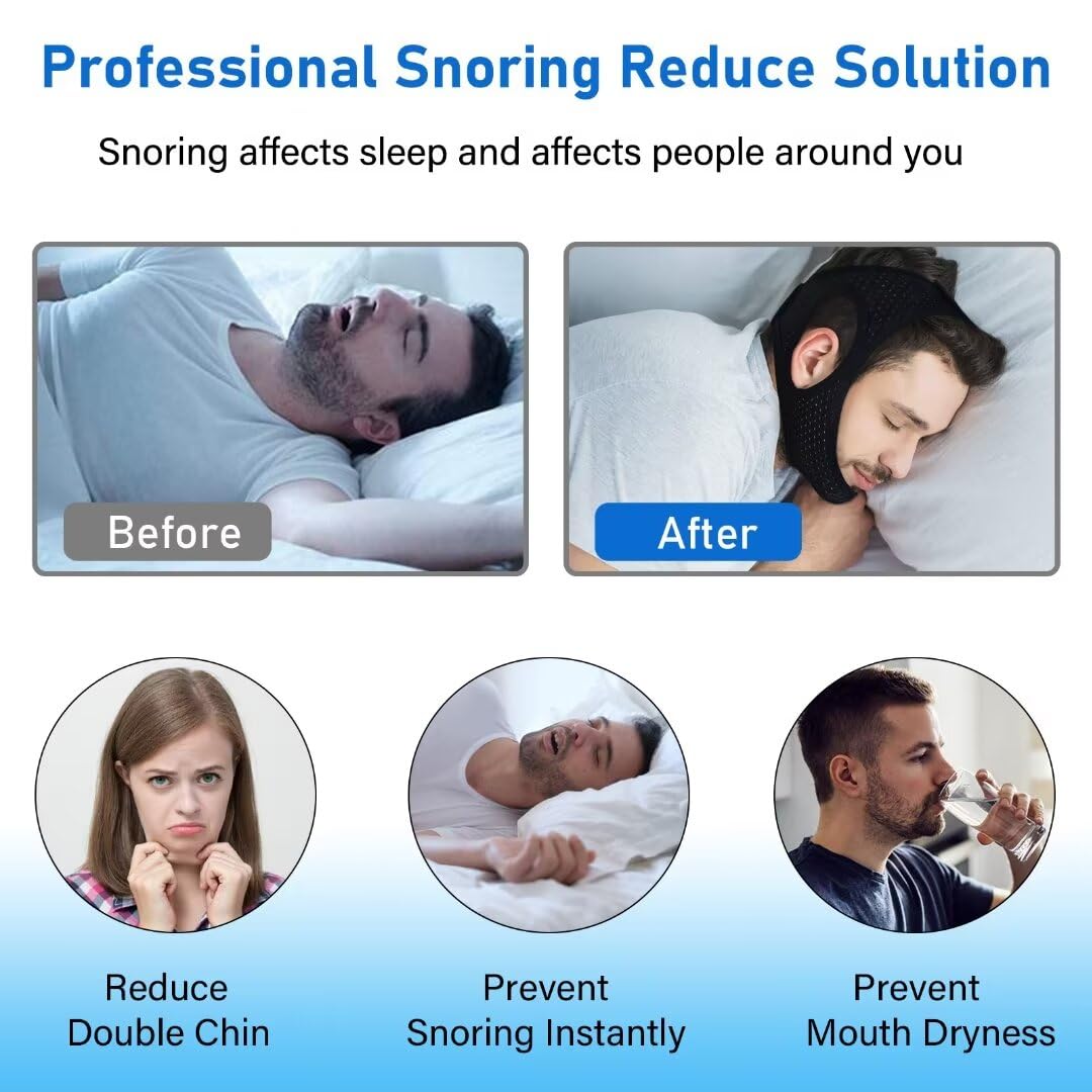Forzacx Anti Snore Chin Strap - Breathable Chin Strap Snoring Solution, Effectively Reduce Snoring, Non-Stick Hair, Don't Fade - Black