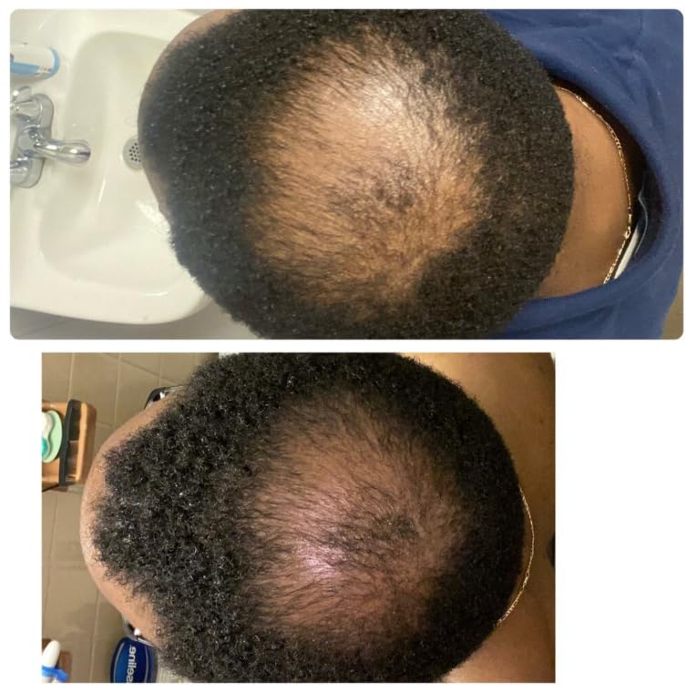 Kreyol Essence - Scalp Care Conditioner with Haitian Black Castor, Coconut oil and Aloe Vera Oil, 8 Oz