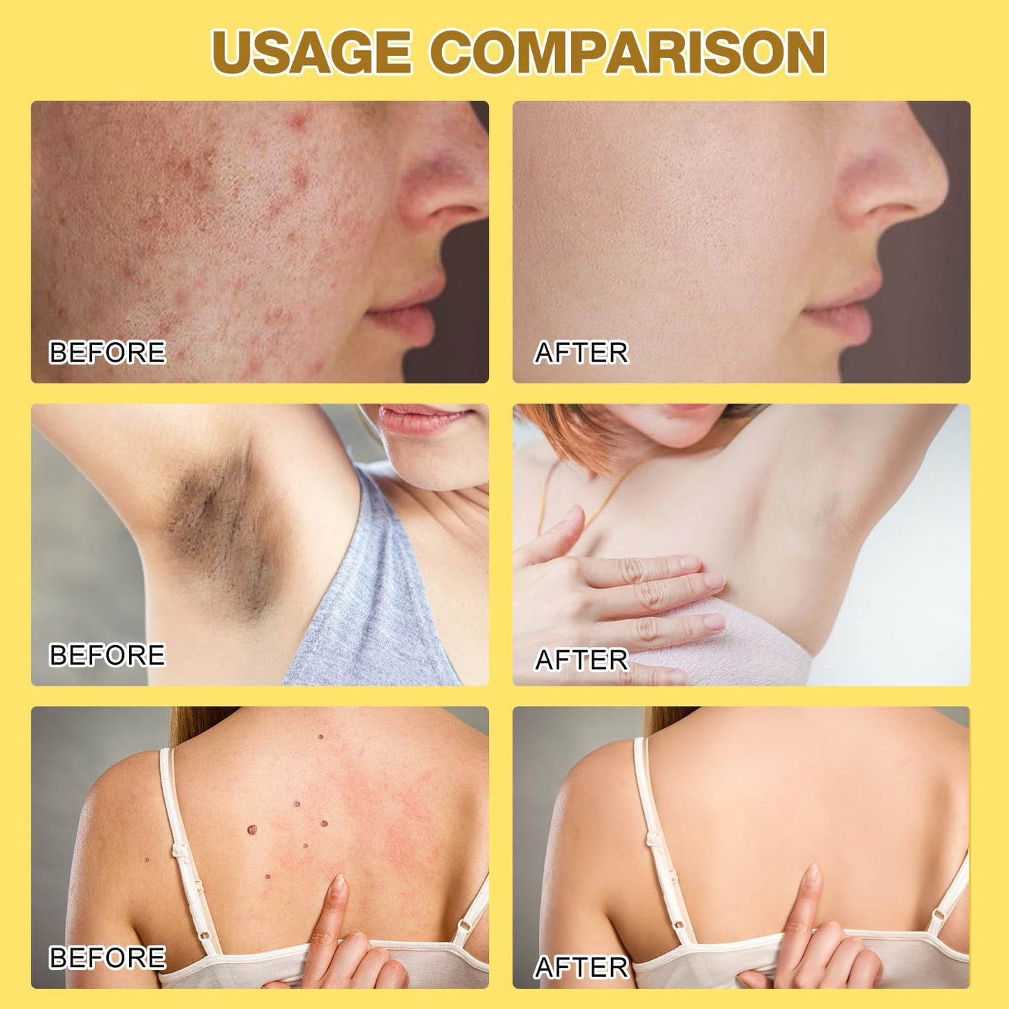 Bee Venom Treatment Cream, 2025 New Professional Bee Venom Repair Cream, For All Body Parts(2 Bottles)
