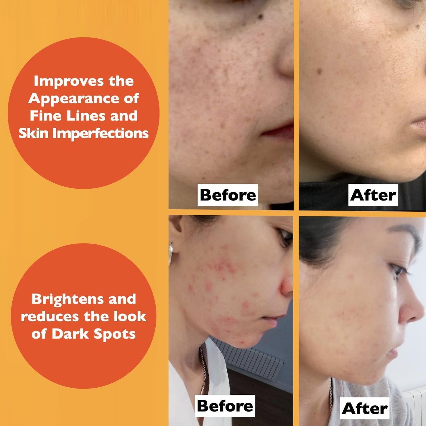 Vitamin C Serum For Face - Anti-Aging Facial Serum with Vitamin C, Hyaluronic Acid, Niacinamide, B5 & Vit E. Brightening Facial