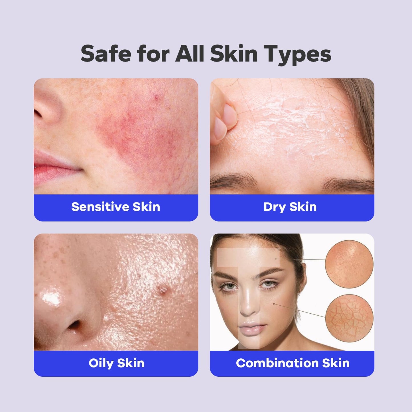 SilkyShark Salicylic Acid Spray (5.07 Fl Oz), 2% Salicylic Acid Body Spray, Body Acne Treatment for Bacne, Blackheads & Blemishe