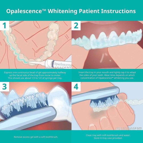 Opalescence 20% Gel Syringes Teeth Whitening - Refill Kit (8 Syringes) Carbamide Peroxide, Fluoride. Made by Ultradent, in Mint Flavor. Tooth Whitening - 5196-4