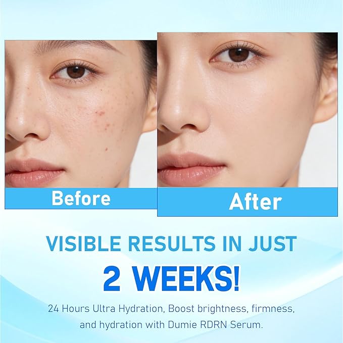 PDRN Serum, 5000ppm Salmon DNA Ampoule, 2000ppm Collagen, Glutathione, Niacinamide & 6in1 Hyaluronic Acids for Wrinkle anti-aging 30Count (1)