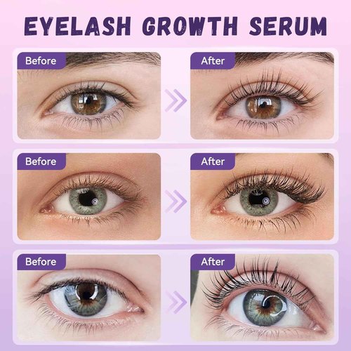 Eyelash Growth Serum, Premium Lash Serum Promotes Longer, Thicker(Gold)