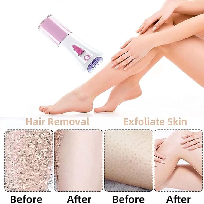 Glabrouse Skin Epilator,2025 New Glamorous Skin Facial Hair Remover for Women Face, Women's Electric Shaver for Underarm Hair Removal Ladies' Hair Removal Device (1)