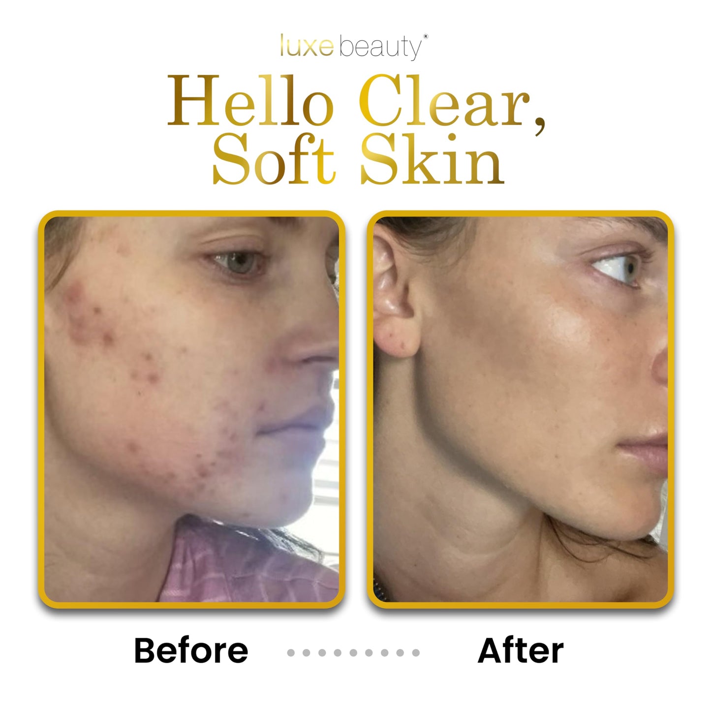 Non Greasy Hyaluronic Acid Moisturizer for Face, Neck & Hands - Grapefruit-Scented Hyaluronic Acid Body Lotion - Anti Aging, Sil