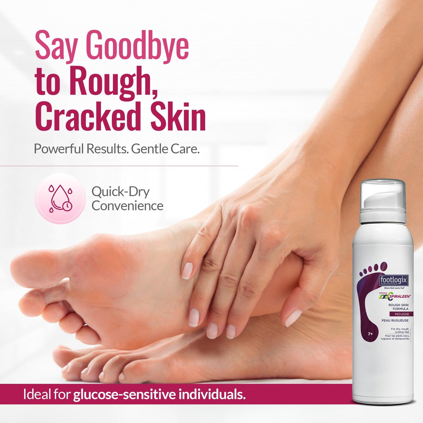 Footlogix Rough Skin Formula with Spiraleen - Mousse for Dry Cracked Heels and Feet, Foot Care for Men and Women, Dry Cracked Fe
