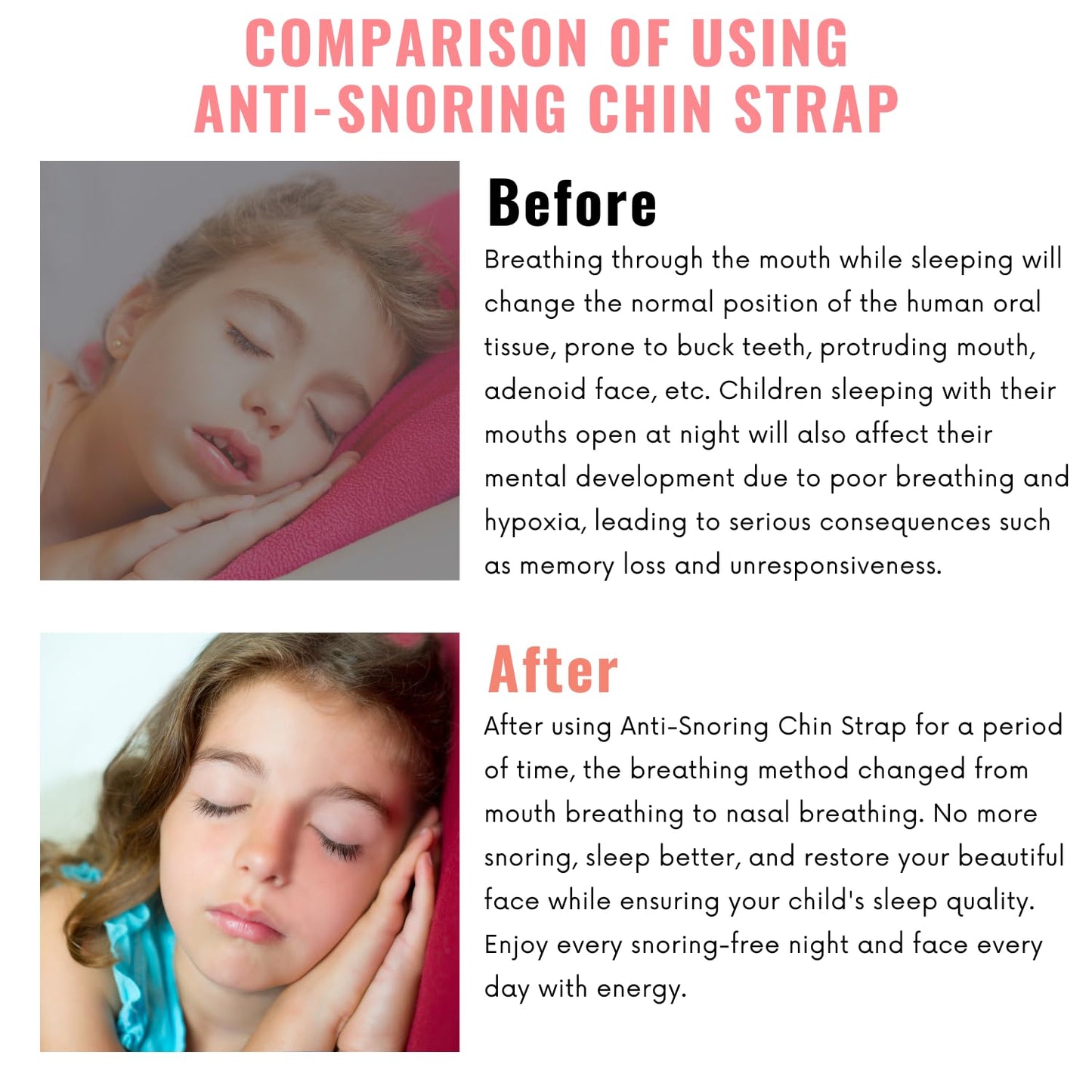 Orapink Anti-Snoring Chin Strap, Small Size Chin Strap for Snoring, Reduce Snoring - Breathable Anti Snoring Device, Sleep Aid Solution Flexible Adjustable Face Slimmer
