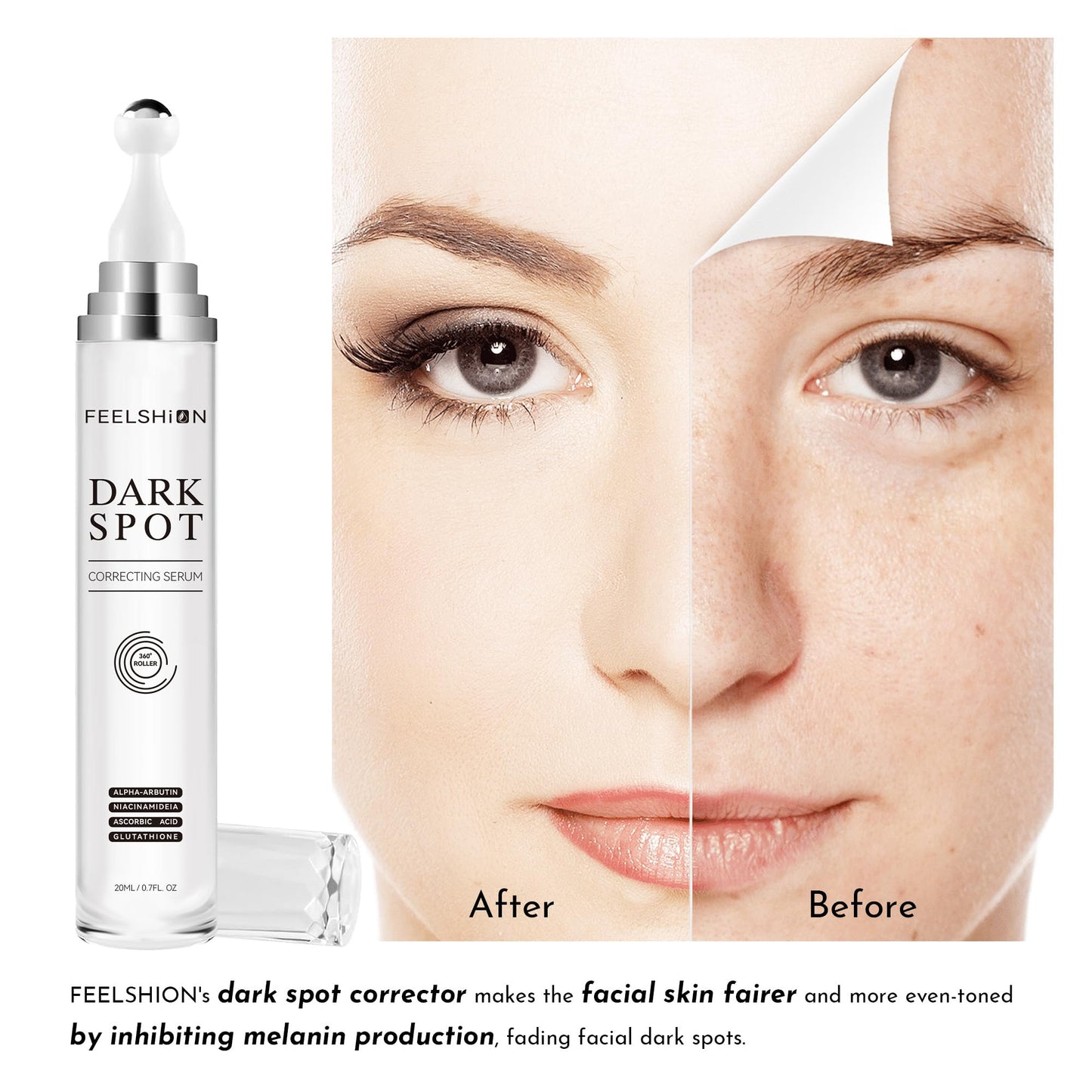 Dark Spot Remover Serum for Face & Body - Vitamin C & a-Arbutin Facial Dark Spot Corrector for Stubborn Melasma, Sun Spots & Fre