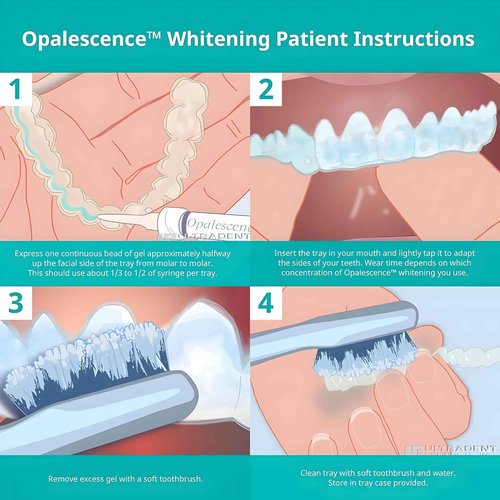 Opalescence 10% Teeth Whitening Kit - Gel Syringes Refills - Low Sensitivy (8 Units) - Fluoride, Carbamide Peroxide - Made in The USA by Ultradent 5211-4
