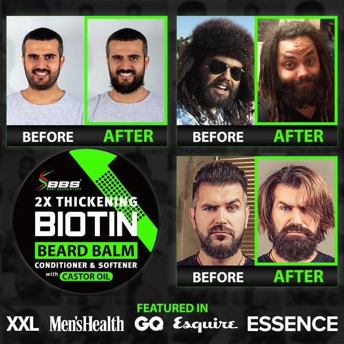 Biotin Beard Balm + XXL Beard Growth Serum + 620,000mcg Beard Growth Vitamins – Beard Growth Kit for Men with Mustache Wax, Collagen, MSM & Castor Oil – Fills Patches, Thickens & Styles