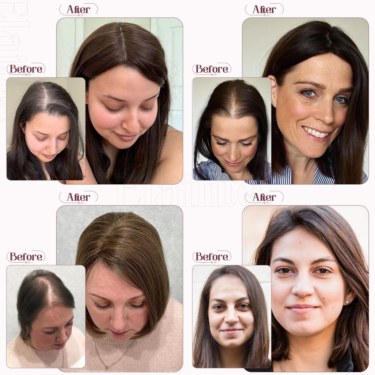 Elailite Hair Toppers for Women Real Human Hair Topper Thinning Thin 5.1x2.8 Silk Base Clip in Remy Hairpieces 14 Inch Sandy Blo