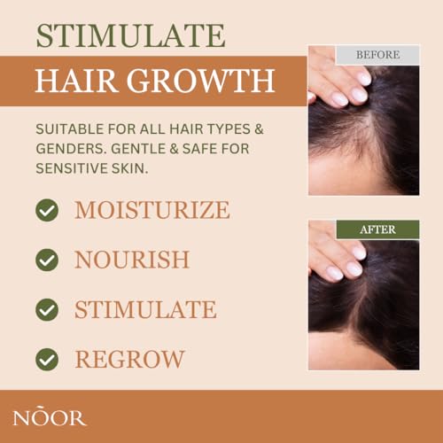 NOOR HAIR Rosemary Growth Spray for Women, Natural Nutrients Hair Loss Treatment for Damaged, Thicker and Healthier Hair, 8-12 Weeks for Significant Hair Growth, Easy Application