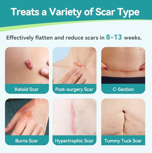 Dimora Hydrogel Burn Dressing & Silicone Scar Sheets