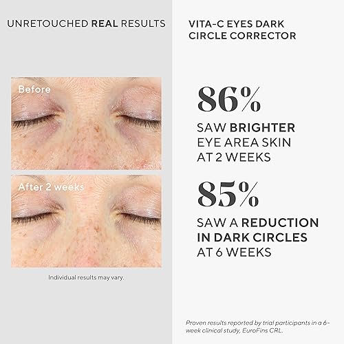 Murad Vita-C Eyes Dark Circle Corrector ? Gold-Stabilized Vitamin C, Algae, and Cucumber Eye Serum for Brightening, Reducing Puffiness, and Smoothing Fine Lines ? 0.5 Fl Oz