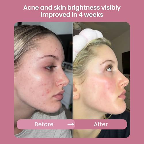 Kay¡¯s Glow Vitamin C Serum for Face with Oxygen & THD - Illuminating Brightening AHA Serum, Anti-Aging Dark Spot Care for Even Tone, Smooth Texture & Hydrating Primer, 1 oz