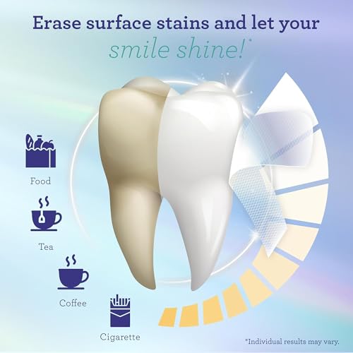 GuruNanda Teeth Whitening Strips - 7-Day Treatment with Non-Slip, Dry Strip Technology - Whitening Designed with Care for ...