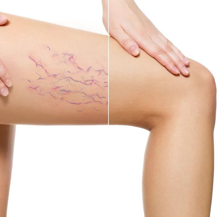 LUMINESS Airbrush Body Coverage - Tattoo Cover Up Makeup - Full Coverage Foundation for Face & Body - Water-Resistant, Long-Wear
