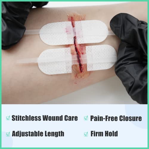 RHINO RESCUE Wound Closure Kit, 6pcs with Dresssings, Wound Closure Strips Without Suture, Stitch Zip Laceration Closure K...