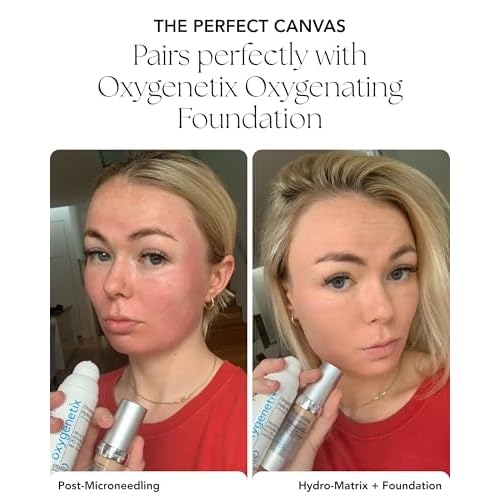 Oxygenetix Oxygenating Hydro-Matrix | Lightweight Aloe-Based Face Moisturizer with Hyaluronic Acid for Sensitive, Dry, or Compromised Skin