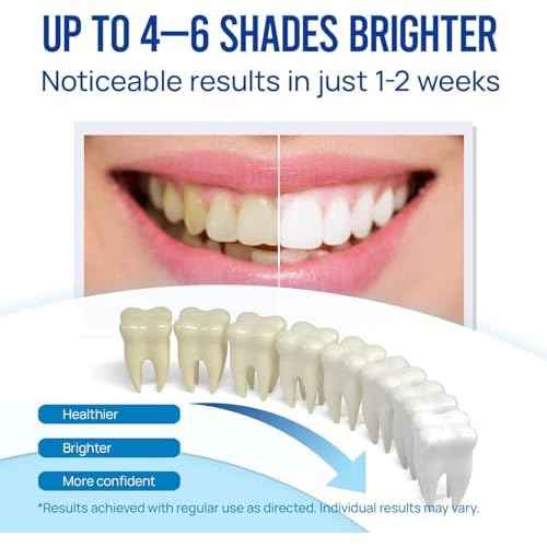 VieBeauti Teeth Whitening Pen (3 Pcs), 30+ Uses, Effective, Painless, No Sensitivity, Travel-Friendly, Easy to Use, Beautiful White Smile, Mint Flavor