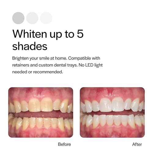 Opalescence 20% Teeth Whitening Refill Kit (4 Syringes) Carbamide Peroxide. Made by Ultradent, in Mint Flavor. Tooth Whitening Refill Syringes - B-5196-4