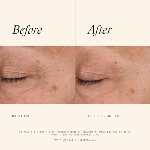 SkinMedica Retinol 1.0 Complex - Retinol Serum for Face, Age-Defying Advanced Retinol Cream That Renews Skin and Diminishe...