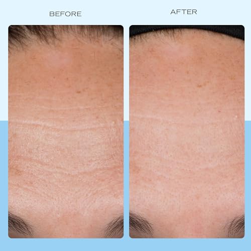 First Aid Beauty Firming Collagen Cream with Collagen, Peptides and Niacinamide – Day + Night Anti-Aging Face Moisturizer...
