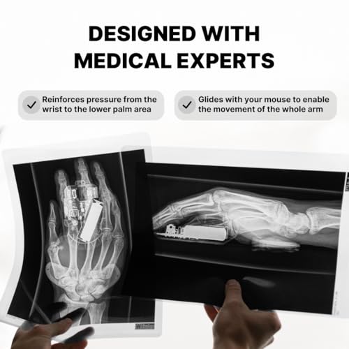 DELTAHUB Carpio 2.0 - Right-Handed Truly Ergonomic Wrist Rest for Mouse, Carpal Tunnel Support, Pain Relief, Anti-Fatigue,...