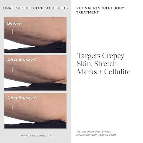 Murad Retinal ReSculpt Body Treatment ? Encapsulated Retinal, Shea & Avocado Extract Body Cream to Firm, Lift, and Smooth Crepey Sagging Skin, Targeting Cellulite and Stretch Marks Nightly ? 5.0 Fl Oz