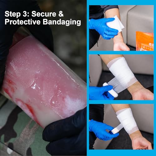 RHINO RESCUE Burn Kit, 4pcs Burn Dressings 4x4”, 8pcs Burn Gel Packets 3.5g, 4pcs Burn Pads, First Aid Kit Cooling Soothin...