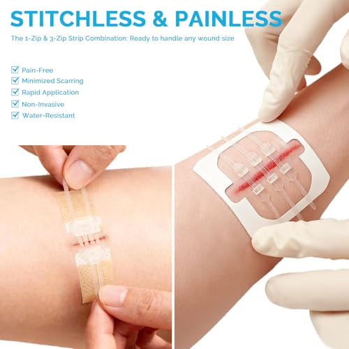 Emergency Wound Closure Strips 16Pcs Zipstitch Laceration Closure Kit, 2 Types Easy to Use Stitchless Butterfly Bandages f...