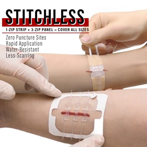 EVERLIT Wound Closure Kit | Surgical Zip-Stitch Devices for Cut & Laceration | Sterile, Suture-Free, Stitch-Less Adhesive ...