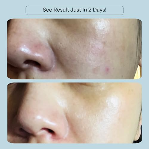 CelRevive B-Restore¢â Barrier Cream soothes, hydrates, and supports microbiome balance, restoring comfort to sensitive, dry skin. EWG Verified¢â for safety and transparency. Made in Australia
