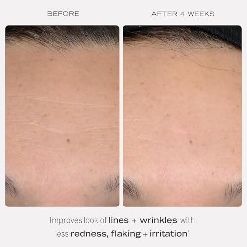 First Aid Beauty - 0.3% Retinol Complex Serum with Peptides, Designed for Sensitive Skin, Helps Visibly Improve Lines and ...