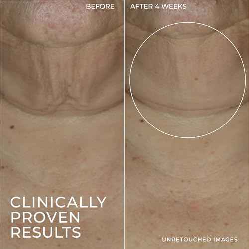 RoC Derm Correxion Retinol Firming Serum Stick with Antioxidants to Visibly Tighten and Firm Wrinkles and Laugh Lines 1.0 oz plus Retinol Eye Cream Packette