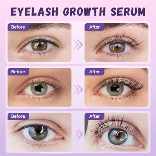 Eyelash Growth Serum, Premium Lash Serum Promotes Longer, Thicker£¨Gold£©