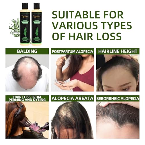 Organic Rosemary Hair Growth Shampoo for Women and Men-Natural Thickening & Strengthening Shampoo with Hydrolyzed Keratin for Thinning Hair & Hair Loss 7.4 fl.oz