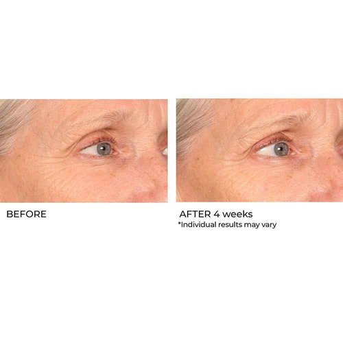 NassifMD Pro Peptide Collagen Serum, Clinical Grade with Premium Ingredients for Hydrated Smooth Skin, Lightweight Fast-Absorbing Anti-Aging Formula for Softer Texture and Healthy Glow, 1 oz