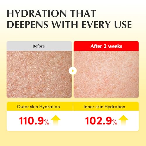 EQQUALBERRY Vitamin Illuminating Cream – Vitamin C & 5% Niacinamide + 3% TXA | Dark spots Cream | Ceramide Barrier Strengt...
