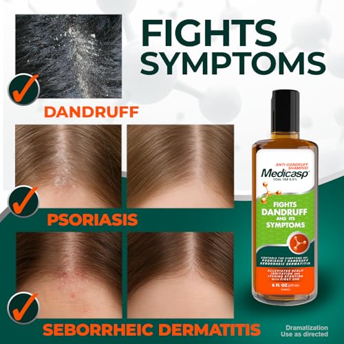 Medicasp Coal Tar Anti-Dandruff Shampoo, Alleviates Symptoms from 1st Wash, Treats Psoriasis, Seborrheic Dermatitis & Itch...