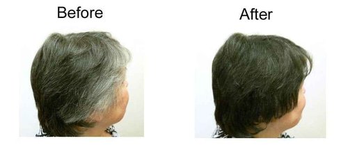 My Secret Hair Enhancer Dark Brown 5oz 3 pack