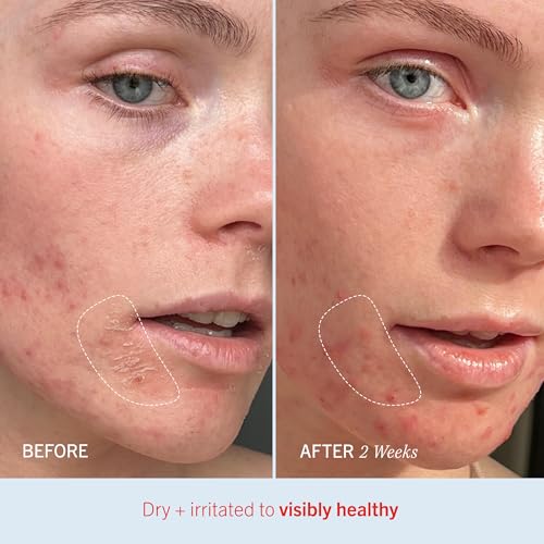 First Aid Beauty - Ultra Repair Cream, Intense Hydration Whipped Colloidal Oatmeal, Clinically Proven to Strengthen Skin B...