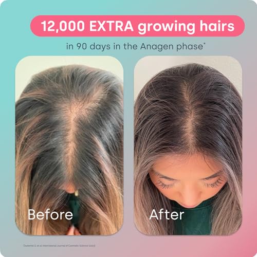 Biosil Advanced Hair Growth Formula - 30 Packets - Promotes Hair (re) Growth, Prevents Hair Loss and Shedding & Increases Thickness and Strength - with Patented ch-OSA - 1 Month Supply