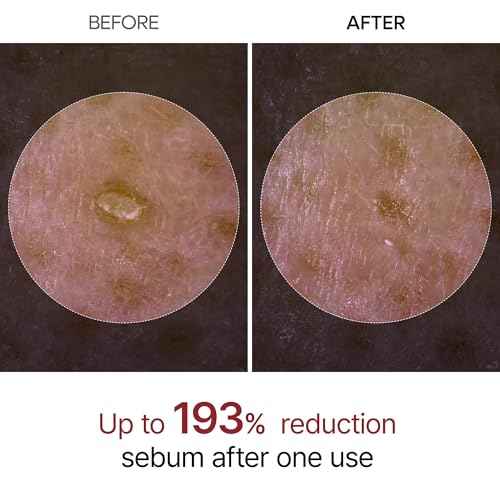 Dr.Melaxin Peel Shot Glow Black Rice Peeling Ampoule 80ml Daily Soft Exfoliating Face and Body Scrub Dead Skin Cells Remover for All Skin Types korean skin care