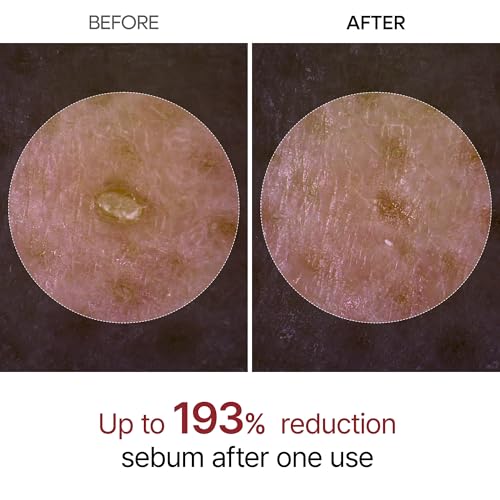 Dr.Melaxin Peel Shot Glow Rice Peeling Ampoule 80ml Daily Soft Exfoliating Face and Body Scrub Dead Skin Cells Blackhead R...