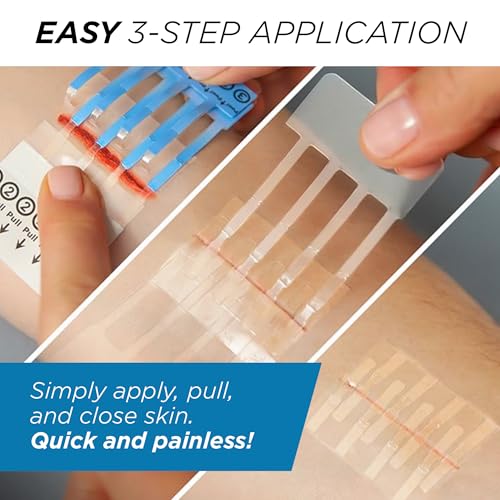 Clozex Complete Emergency Laceration Kit - Repair Wounds Without Stitches, FSA HSA Eligible Skin Clean Cover Closure Devic...