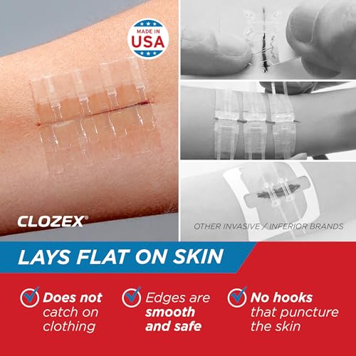 Clozex Complete Emergency Laceration Kit - Repair Wounds Without Stitches, FSA HSA Eligible Skin Clean Cover Closure Devic...